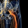 Wenn der Nerv schmerzt und der Schmerz nervt: Das Ischiassyndrom